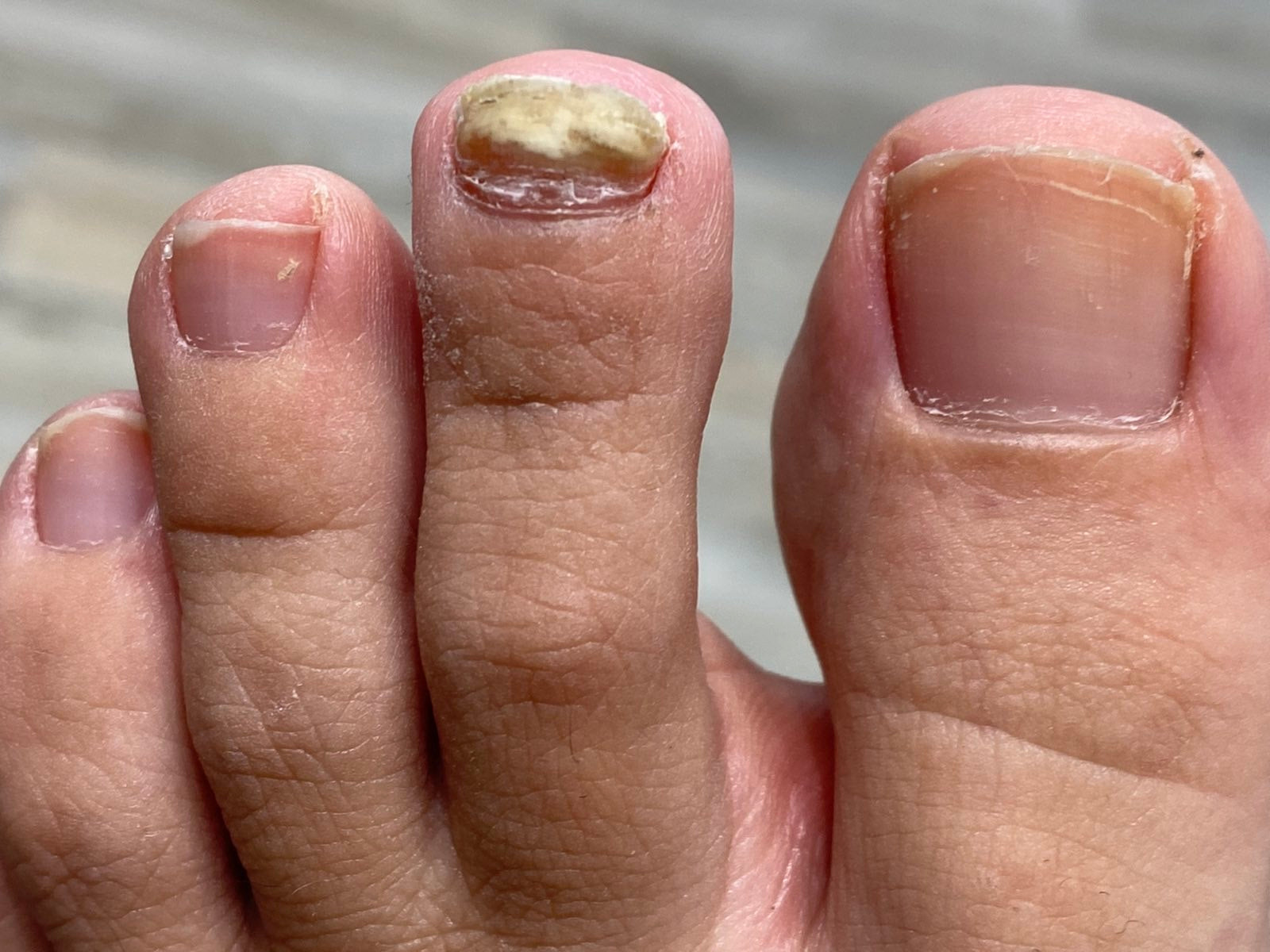 COSMOHERB ONYCHOIL ELIXIR