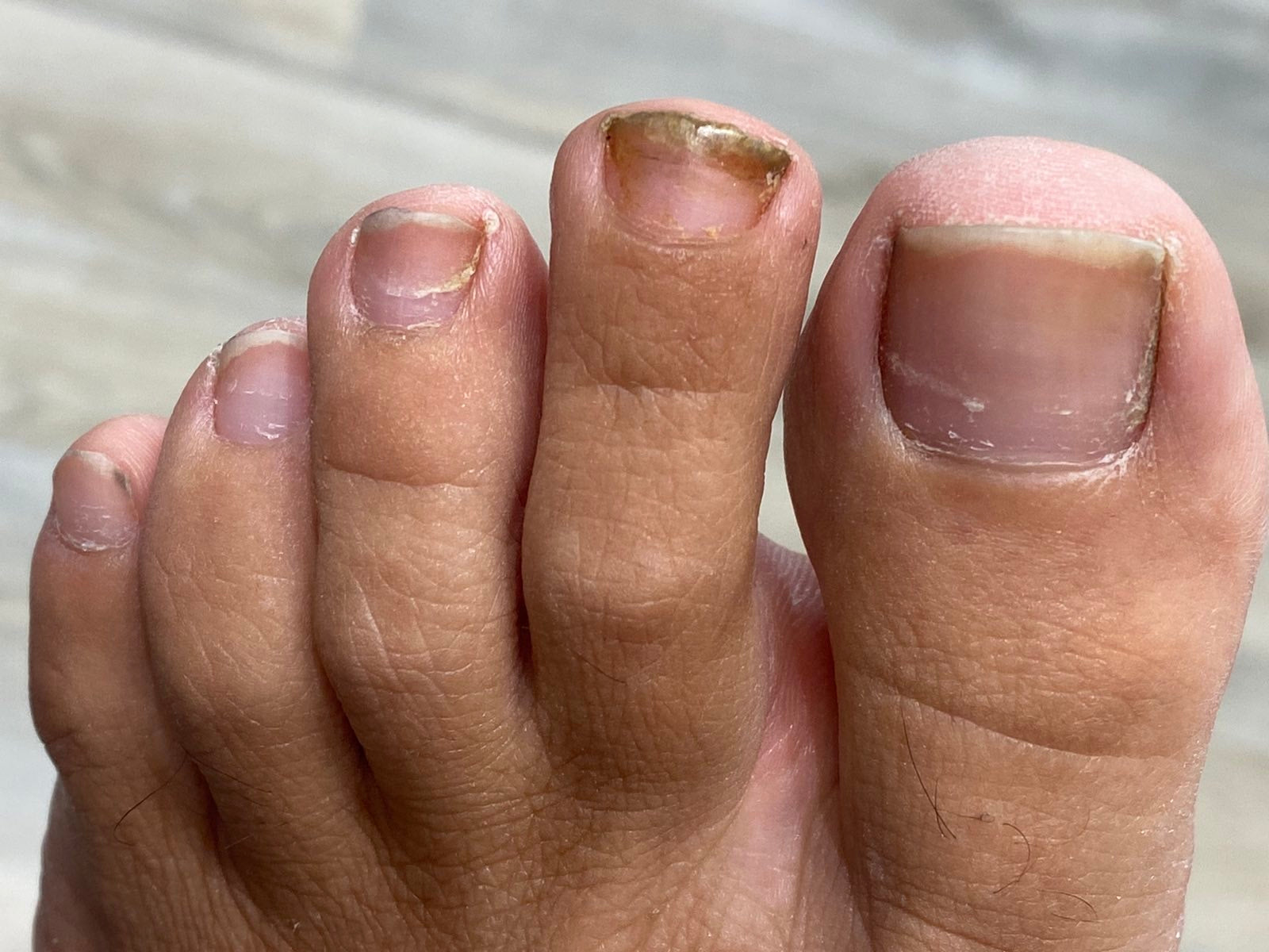 COSMOHERB ONYCHOIL ELIXIR